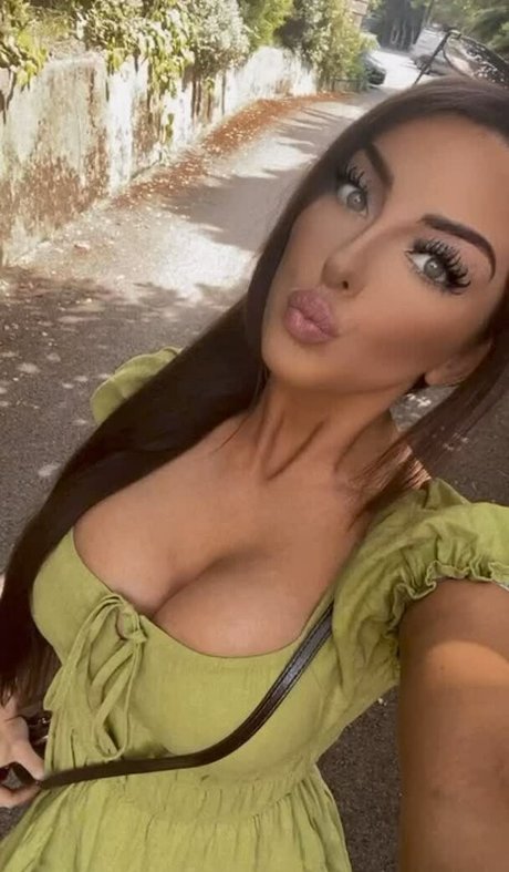 Misskayleighrosedematos