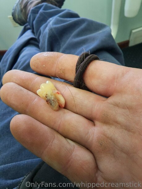 Whippedcreamstick