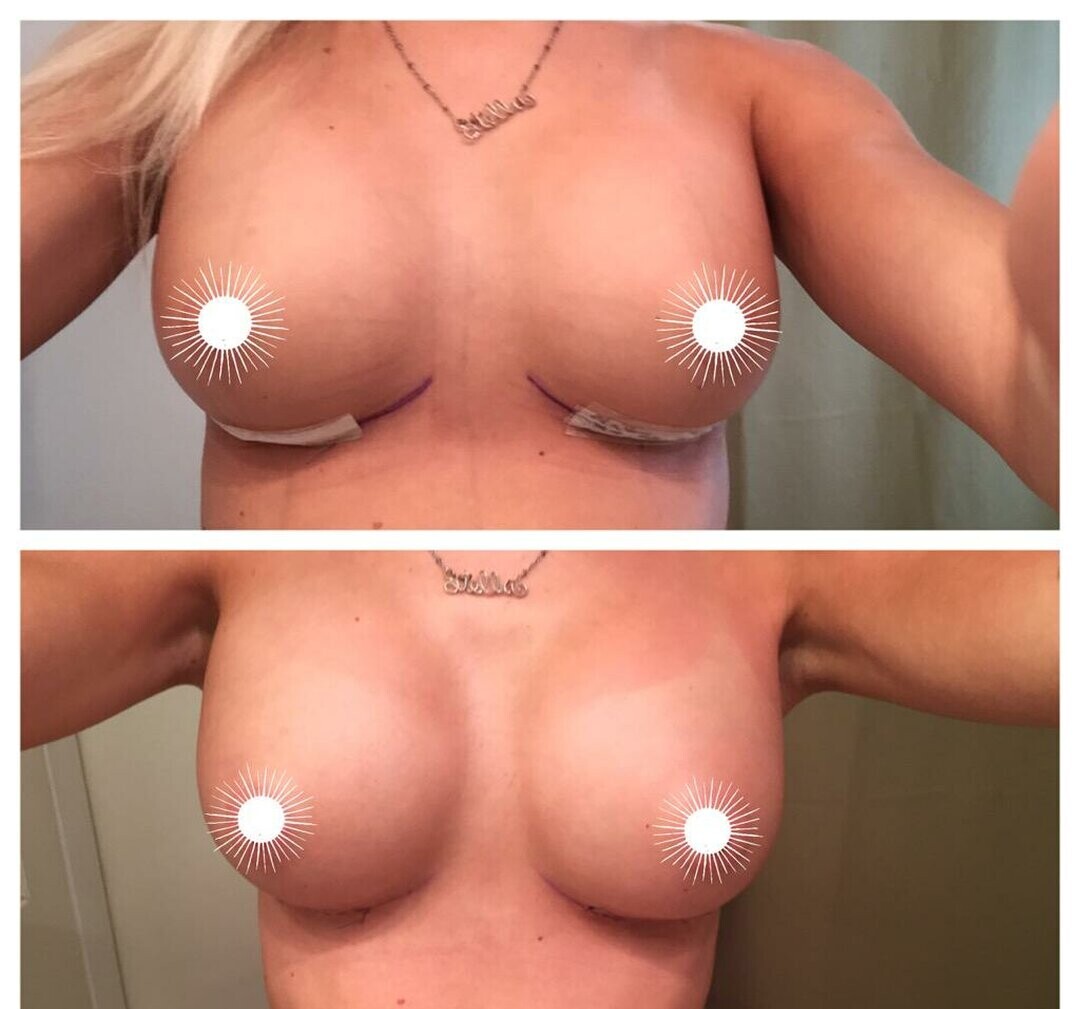 Foto di nudo di fuga di OnlyFans di Stella The Light #28 Foto di nudo di fuga di OnlyFans di Stella The Light #28