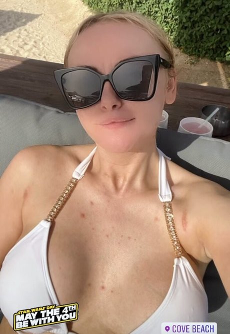 Katie McGlynn