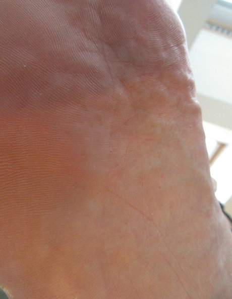 Neolasoles