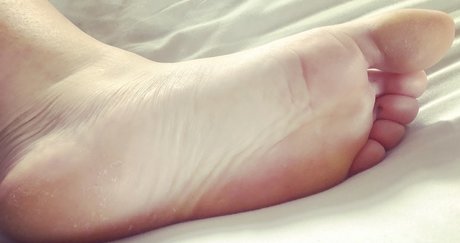 Candyfeet