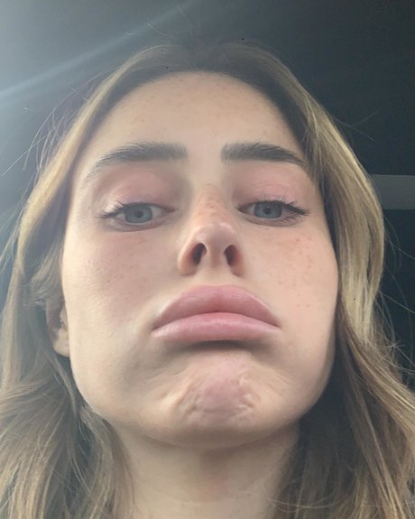 Effy Palarya