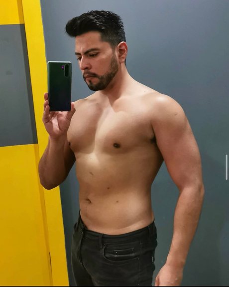 Foto di nudo di fuga di OnlyFans di Medivlog