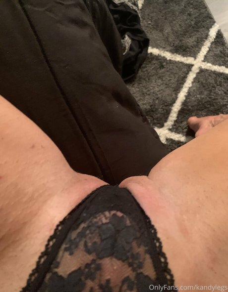 Foto di nudo di fuga di OnlyFans di Kandylegs