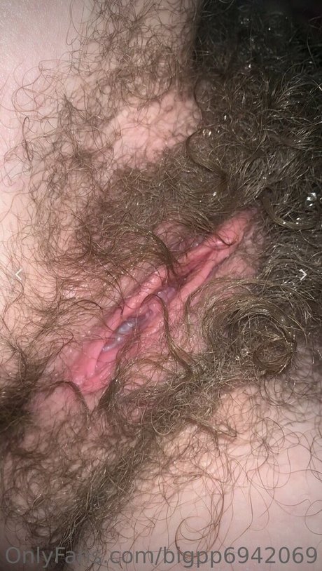 Hairy Women
