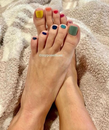 Myposedtoes