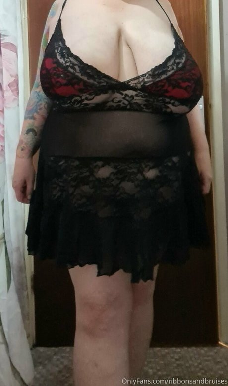 Ribbonsandbruises